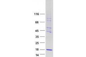 Validation with Western Blot