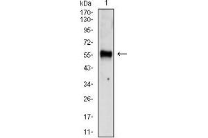 Western Blotting (WB) image for anti-Chromogranin A (CHGA) (AA 278-457) antibody (ABIN7193659)