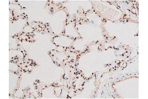 ABIN6267601 at 1/200 staining Rat lung tissue sections by IHC-P. (NF-kB p65 antibody  (pThr435))