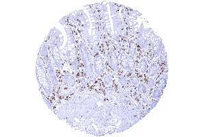 Strong CD5 immunostaining of T lymphocytes in the ileum mucosa (Recombinant CD5 antibody  (AA 32-372))