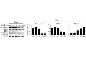 Western Blotting (WB) image for anti-Poly (ADP-Ribose) Polymerase 1 (PARP1) antibody (ABIN2854798)