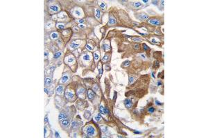 Immunohistochemistry (IHC) image for anti-GTPase NRas (NRAS) antibody (ABIN3003468) (GTPase NRas antibody)