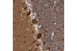 Immunohistochemical staining of human cerebellum with MSL1 polyclonal antibody  shows strong cytoplasmic positivity in Purkinje cells.