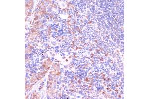 Immunohistochemistry of paraffin-embedded mouse spleen using UGT2B15 antibody (ABIN7271194) at dilution of 1:100 (40x lens).