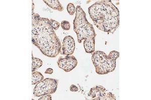 Immunohistochemistry (Paraffin-embedded Sections) (IHC (p)) image for anti-Sphingosine-1-Phosphate Phosphatase 1 (SGPP1) (AA 13-42), (N-Term) antibody (ABIN657152)
