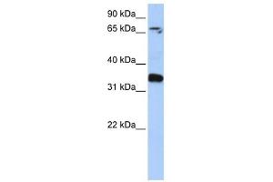 GLE1 antibody used at 1 ug/ml to detect target protein.