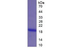 SDS-PAGE (SDS) image for Matrix Gla Protein (MGP) (AA 20-103) protein (His tag) (ABIN1080256) (MGP Protein (AA 20-103) (His tag))
