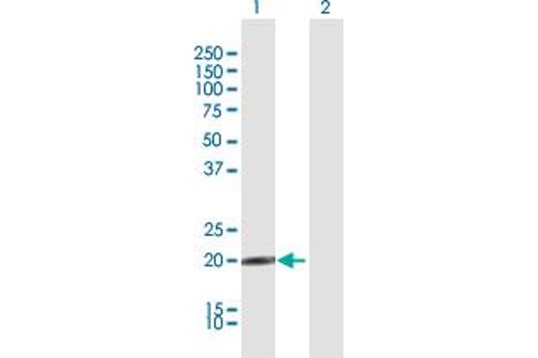 IFNA10 antibody  (AA 1-189)