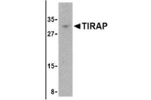 Image no. 1 for anti-Toll-Interleukin 1 Receptor (TIR) Domain Containing Adaptor Protein (TIRAP) (Middle Region) antibody (ABIN265135) (TIRAP antibody  (Middle Region))