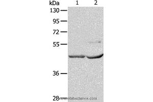 Western blot analysis of Mouse kidney and heart tissue, using NCEH1 Polyclonal Antibody at dilution of 1:1350