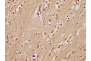 IHC image of ABIN7165518 diluted at 1:200 and staining in paraffin-embedded human brain tissue performed on a Leica BondTM system.