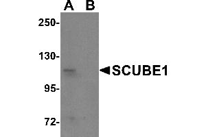 Western Blotting (WB) image for anti-Signal Peptide, CUB Domain, EGF-Like 1 (SCUBE1) (Middle Region) antibody (ABIN1031082)