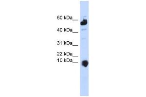 Western Blotting (WB) image for anti-Chromosome 1 Open Reading Frame 151 (C1orf151) antibody (ABIN2458895) (C1orf151 antibody)