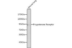 Western blot analysis of extracts of mouse lung, using Progesterone Receptor antibody (ABIN3022926, ABIN3022927, ABIN3022928 and ABIN6219301) at 1:500 dilution. (Progesterone Receptor antibody  (C-Term))