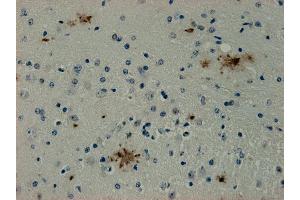 Immunohistochemistry (IHC) image for anti-Syndecan Binding Protein (Syntenin) (SDCBP) antibody (ABIN1742301) (SDCBP antibody)