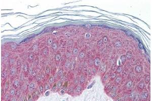 Human Skin: Formalin-Fixed, Paraffin-Embedded (FFPE) (IL-33 antibody  (AA 36-85))