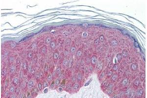 Human Skin: Formalin-Fixed, Paraffin-Embedded (FFPE) (IL-33 antibody  (AA 36-85))