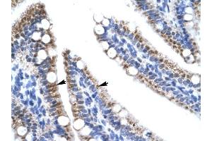 ZNF12 antibody was used for immunohistochemistry at a concentration of 4-8 ug/ml to stain Epithelial cells of intestinal villus (arrows) in Human Intestine.