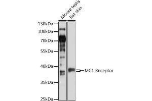 Western blot analysis of extracts of various cell lines, using MC1 Receptor antibody (ABIN6132878, ABIN6143610, ABIN6143612 and ABIN6217539) at 1:1000 dilution. (MC1 Receptor antibody  (AA 1-80))