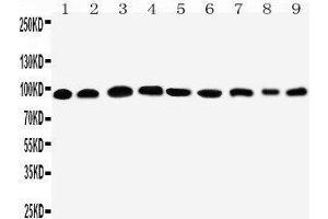 Western Blotting (WB) image for anti-Plakophilin 2 (PKP2) (AA 863-881), (C-Term) antibody (ABIN3042556) (Plakophilin 2 antibody  (C-Term))