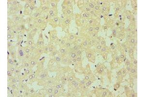 Immunohistochemistry of paraffin-embedded human liver tissue using ABIN7149890 at dilution of 1:100 (DKK4 antibody  (AA 19-224))