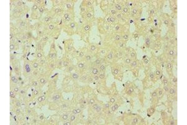 DKK4 antibody  (AA 19-224)