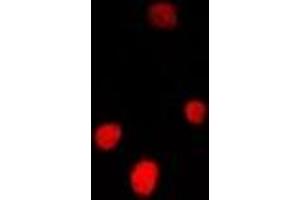 Immunofluorescent analysis of FGF14 staining in U2OS cells. (FGF14 antibody)