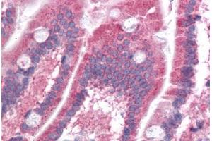 Human Small Intestine: Formalin-Fixed, Paraffin-Embedded (FFPE) (PPAPDC1B antibody  (N-Term))