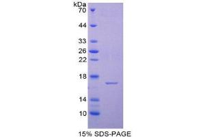 SDS-PAGE (SDS) image for Cystatin E/M (CST6) (AA 29-149) protein (His tag) (ABIN2124551) (CST6 Protein (AA 29-149) (His tag))