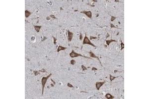 Immunohistochemical staining of human cerebral cortex with CTAGE5 polyclonal antibody  shows strong cytoplasmic positivity in neuronal cells. (MIA2 antibody  (AA 392-507))