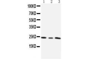 Anti-TIMP4 antibody, Western blotting Lane 1: HT1080 Cell Lysate Lane 2: HELA Cell Lysate Lane 3: SMMC Cell Lysate