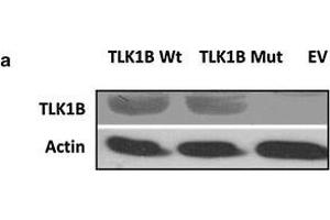 a Overexpression of Wt TLK1B and Mut TLK1B in stably transfected HEK293 cells. (TLK1 antibody)