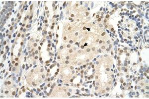 Rabbit Anti-PUF60 Antibody  Paraffin Embedded Tissue: Human Kidney Cellular Data: Epithelial cells of renal tubule Antibody Concentration: 4. (PUF60 antibody  (C-Term))