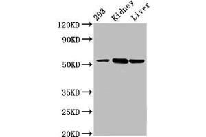 Western Blot Positive WB detected in: 293 whole cell lysate, Mouse kidney tissue, Mouse liver tissue All lanes: DBT antibody at 4. (DBT antibody  (AA 140-259))
