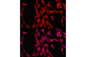 Immunofluorescence analysis of NIH/3T3 cells using LDHA Rabbit mAb  at dilution of 1:100 (40x lens). (Lactate Dehydrogenase A antibody)