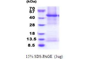 SDS-PAGE (SDS) image for Ectonucleoside Triphosphate diphosphohydrolase 6 (ENTPD6) (AA 61-484) protein (His tag) (ABIN5853855) (ENTPD6 Protein (AA 61-484) (His tag))