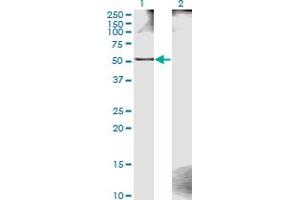 Western Blot analysis of ZWILCH expression in transfected 293T cell line by ZWILCH monoclonal antibody (M11), clone 1C10.