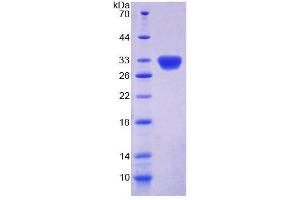 SDS-PAGE analysis of Rat DKC Protein. (DKC1 Protein)