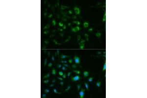 Immunofluorescence analysis of MCF7 cell using TLR8 antibody. (TLR8 antibody  (AA 849-1041))