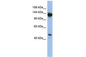Image no. 1 for anti-Nardilysin (N-Arginine Dibasic Convertase) (NRD1) (AA 1079-1128) antibody (ABIN6744312) (NRD1 antibody  (AA 1079-1128))
