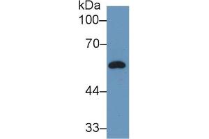 Western Blot; Sample: Rat Plasma; Primary Ab: 2µg/ml Rabbit Anti-Rat DBP Antibody Second Ab: 0. (Vitamin D-Binding Protein antibody  (AA 209-394))