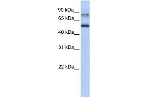 Western Blotting (WB) image for anti-Epsin 1 (EPN1) antibody (ABIN2459834) (Epsin 1 antibody)