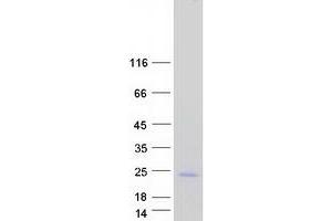 Validation with Western Blot (C17orf49 Protein (Transcript Variant 3) (Myc-DYKDDDDK Tag))
