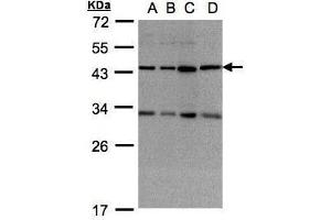 WB Image Sample(30 ug whole cell lysate) A:293T B:A431, C:HeLa S3, D:Raji , 12% SDS PAGE antibody diluted at 1:1000 (DNAJC17 antibody  (Center))