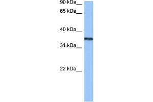 WB Suggested Anti-HNRNPA2B1 Antibody Titration:  0. (HNRNPA2B1 antibody  (N-Term))