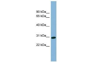 CENPQ antibody used at 1 ug/ml to detect target protein.