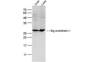 Lane 1: mouse liver lysates Lane 2: rat liver lysates probed with Preproendothelin 1 Polyclonal Antibody, Unconjugated  at 1:300 dilution and 4˚C overnight incubation. (Prepro-Endothelin-1 (AA 16-110) antibody)