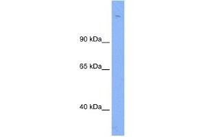 WB Suggested Anti-Sin3b Antibody Titration:  0. (SIN3B antibody  (N-Term))