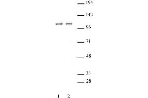 STAT2 antibody (pAb) tested by Immunoprecipitation. (STAT2 antibody  (C-Term))