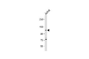 Anti-PKN1 Antibody (C-Term) at 1:2000 dilution + Jurkat whole cell lysate Lysates/proteins at 20 μg per lane. (PKN1 antibody  (AA 836-870))